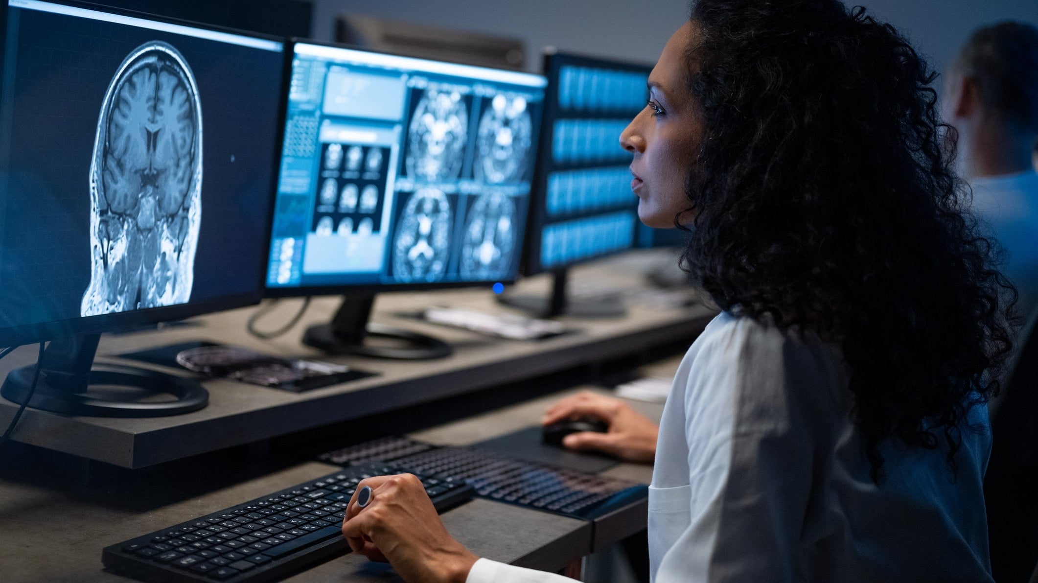 Why Circadian Rhythm May Be Central to Protecting the Brain